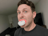 360 Brite Gum Restore Therapy customer -Sem L.